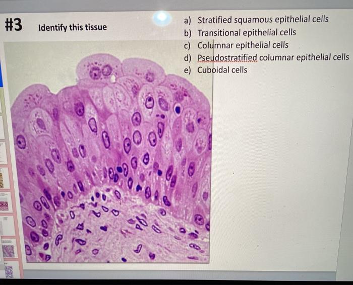 Solved #1 Identify this tissue - a) Hyaline cartilage b) | Chegg.com ...