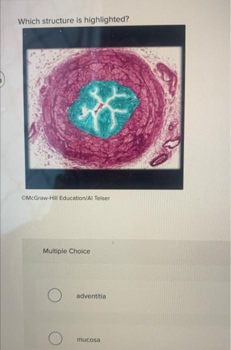 Solved Which Structure Is Highlighted? CMcGraw-Hill | Chegg.com