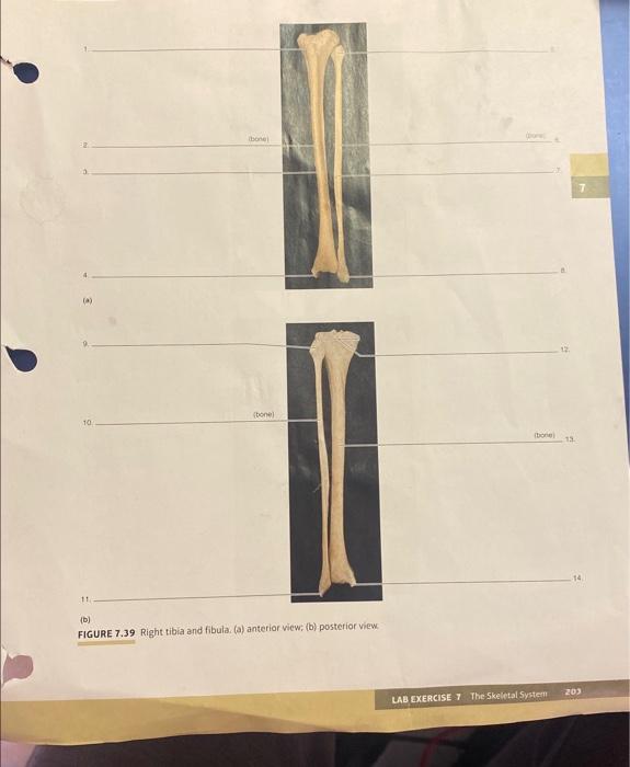 (b) FIGURE 7.39 Right tibia and fibula. (a) anterior view; (b) posteriof view.