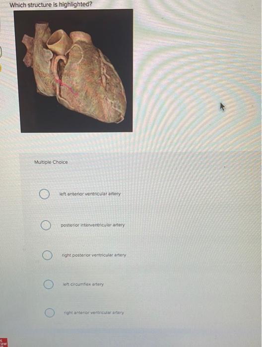 C
raw
Which structure is highlighted?
Multiple Choice
O
left anterior ventricular artery
posterior interventricular artery
ri