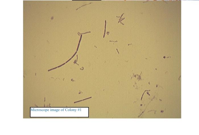 Solved Picture I - Looking down on the Skin Sample (left | Chegg.com