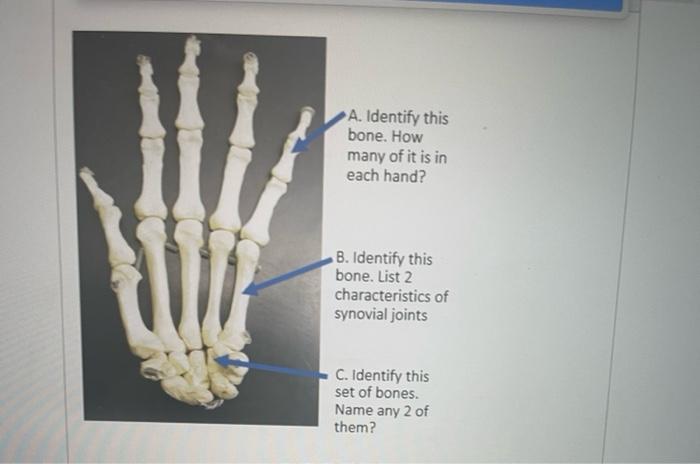 Solved A. Identify this joint What is the structural | Chegg.com