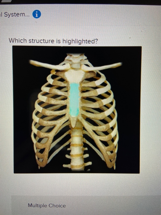 Solved Which structure is highlighted? Multiple Choice