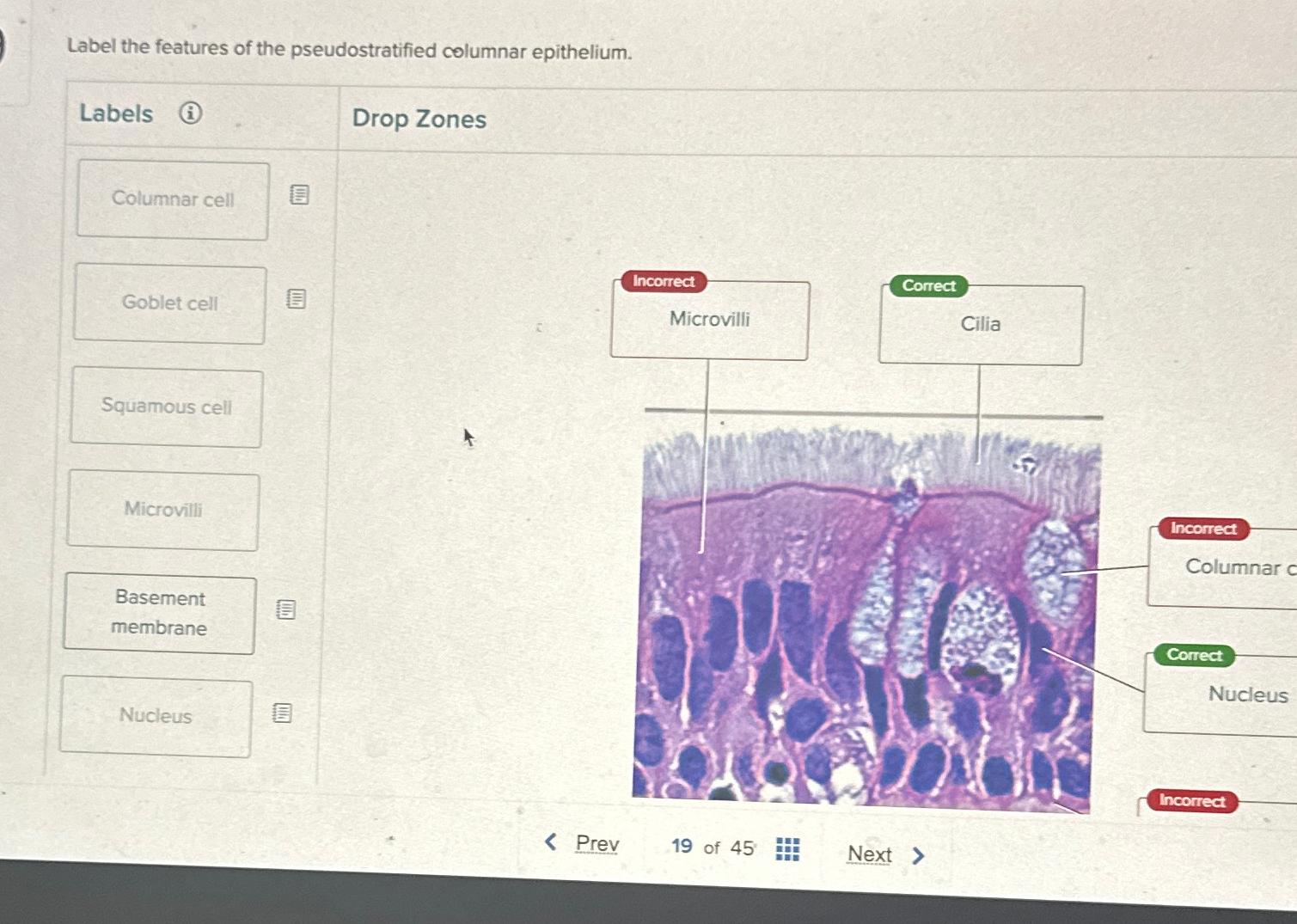 Solved Label the features of the pseudostratified columnar