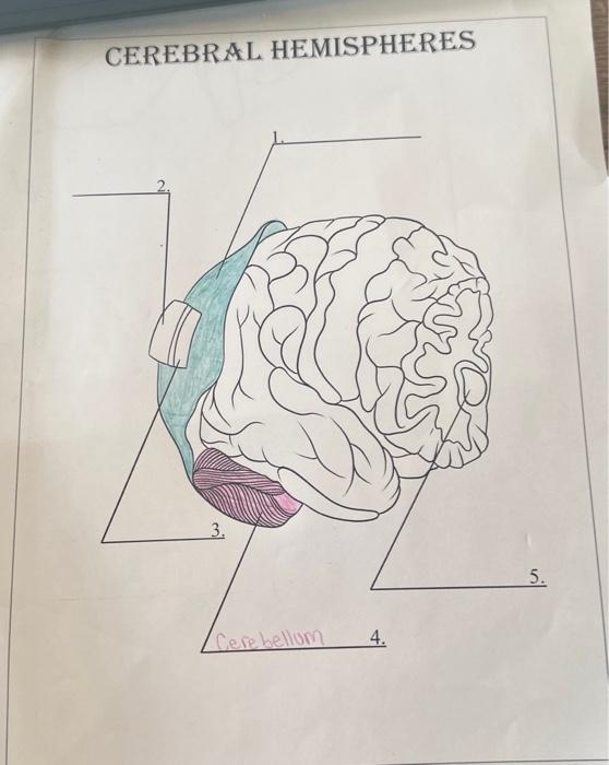CEREBRAL HEMISPHERES cerebral hemispheres | Chegg.com