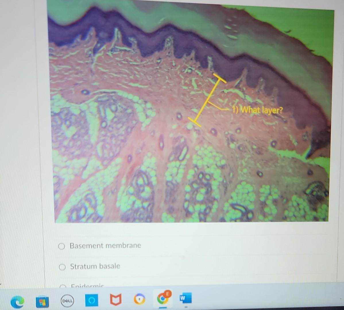 Solved Basement membrane Stratum basale Enidormic DELL What | Chegg.com