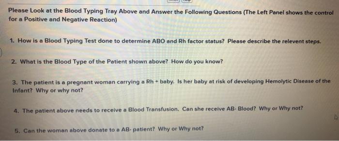 Solved Blood Typing A Rh, B Please Look at the Blood | Chegg.com