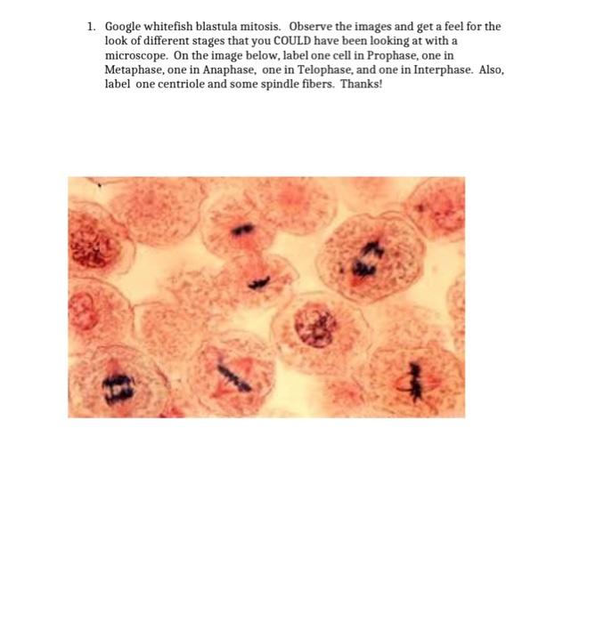 anaphase under microscope