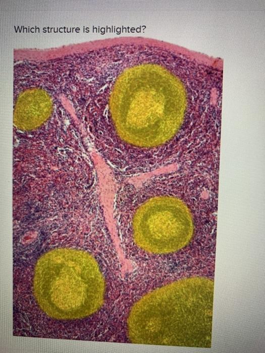 Solved Which structure is highlighted? О. germinal center