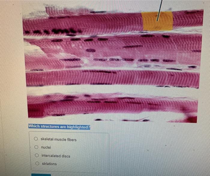 Solved AURON Which structures are highlighted? skeletal