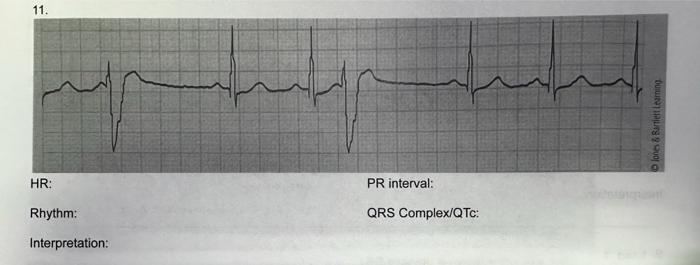 Solved 8. HR: about ≈70bpm Rhythm: Interpretation: PR ...
