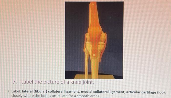 Solved 6. Label the picture of a knee joint. - Label: | Chegg.com