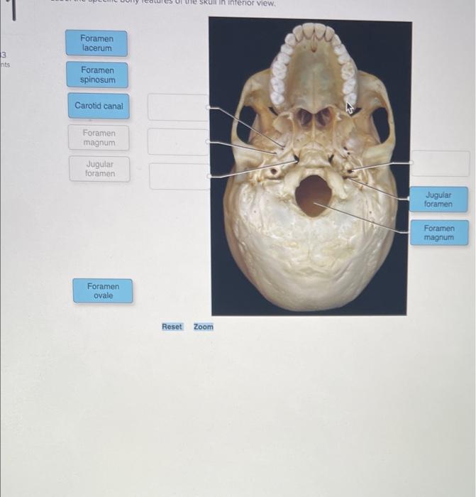 Solved 3 Nts Foramen Lacerum Foramen Spinosum Carotid Ca 1563