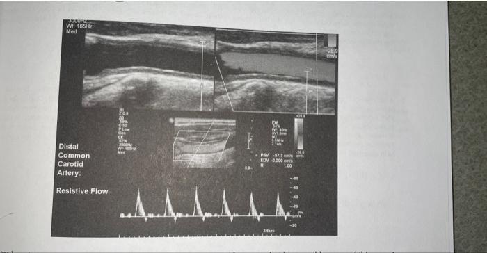 Solved I. A72 yurold female patient presents to the vascular | Chegg.com