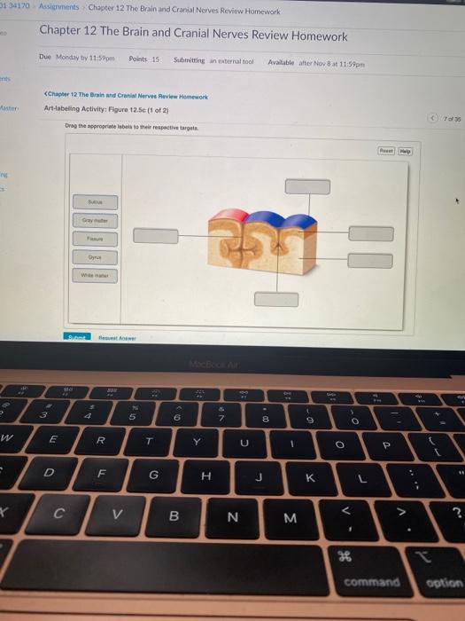 Solved 0134170 Assignments Chapter 12 The Brain And Cranial Chegg Com