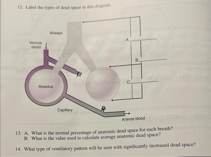 solved-12-label-the-types-of-dead-space-in-this-diagram