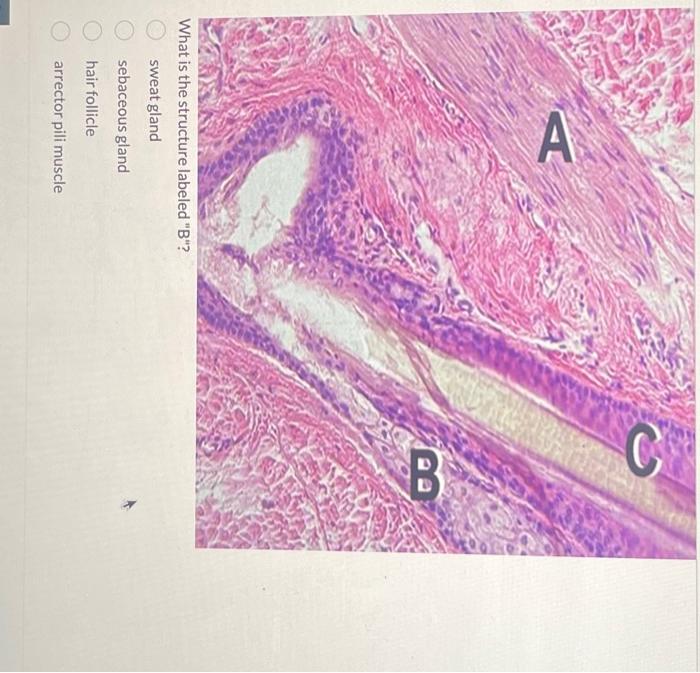 Solved What is the structure labeled "B"? sweat gland