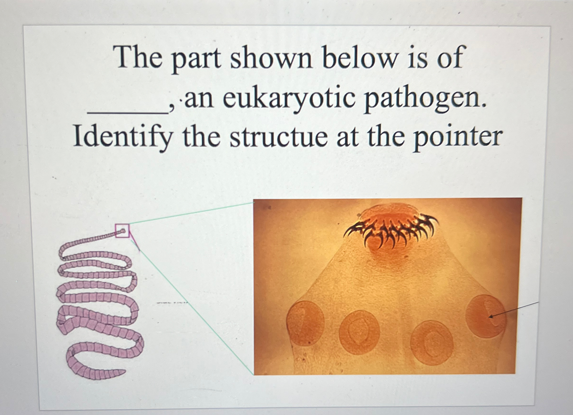 Solved The part shown below is of , ﻿an eukaryotic pathogen. | Chegg.com