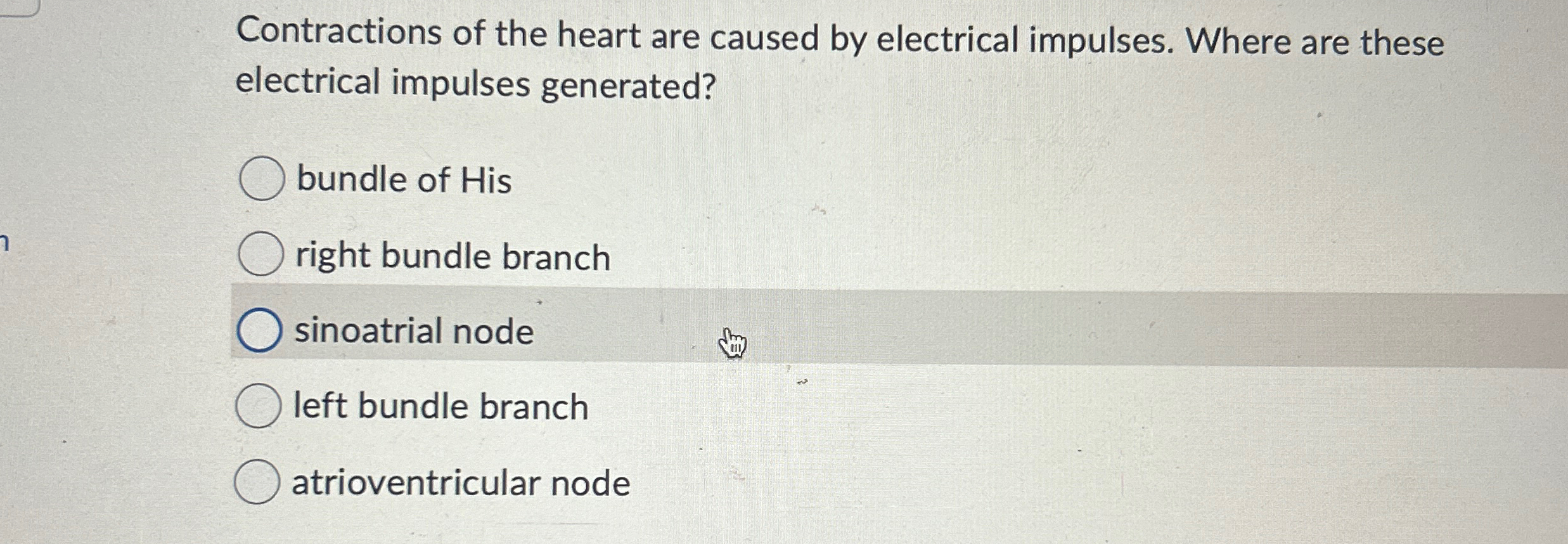 Solved Contractions of the heart are caused by electrical | Chegg.com