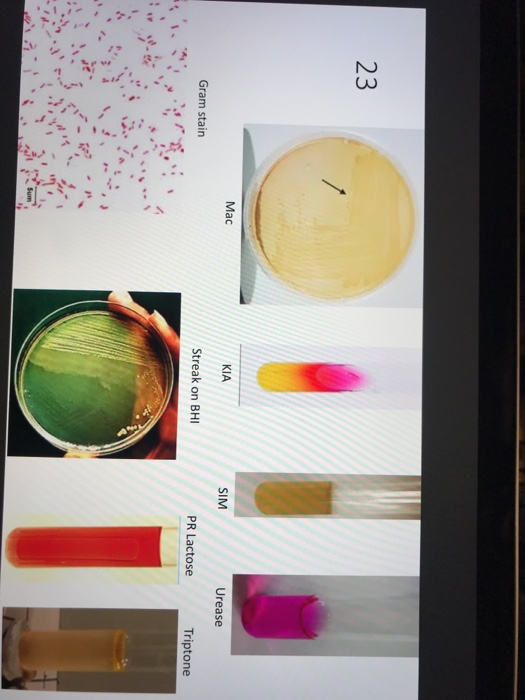 Urease Streaking Solved @ Q Search 23 Mac KIA SIM Urease Gram stain Streak on | Chegg.com