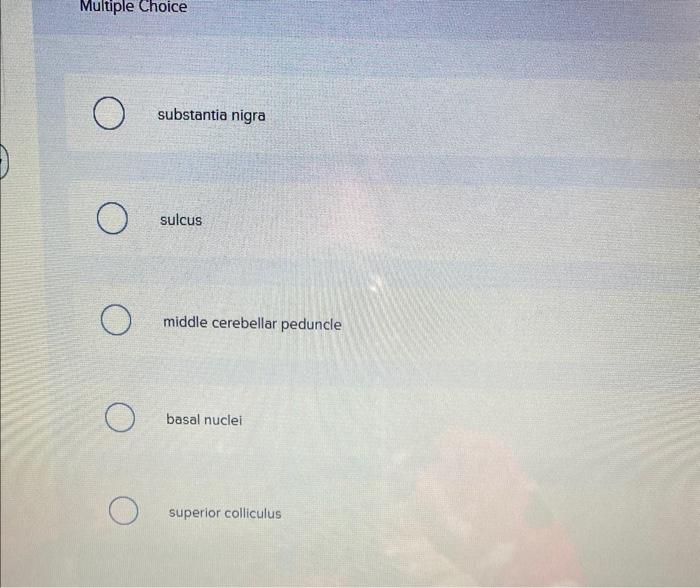 Multiple Choice
substantia nigra
sulcus
middle cerebellar peduncle
basal nuclei
superior colliculus