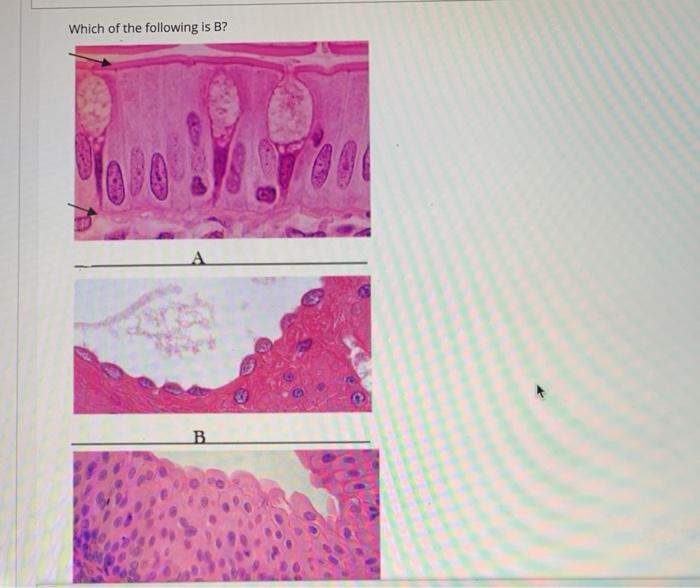 Solved Which Of The Following Is B? B What Type Of | Chegg.com