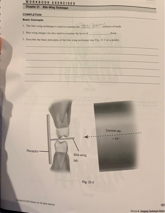 WORKBOOK EXERCISES Chapter 21 BiteWing Technique