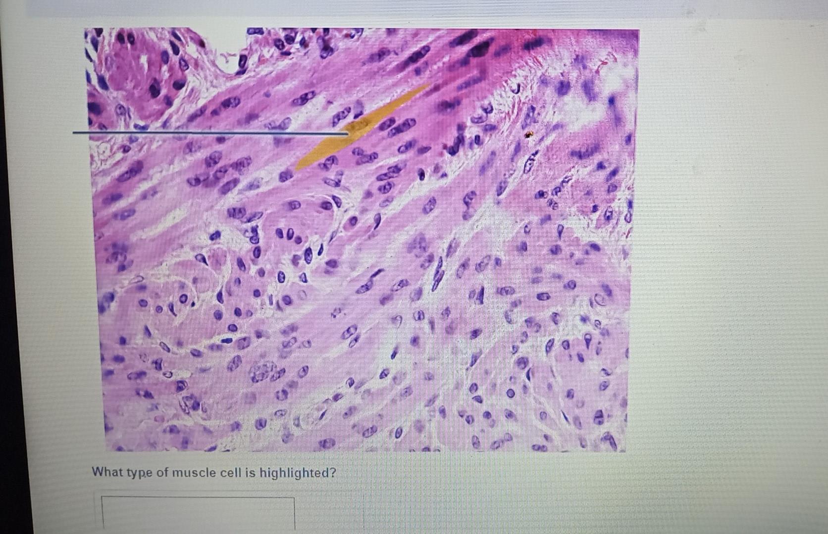 Solved What type of muscle cell is highlighted? | Chegg.com