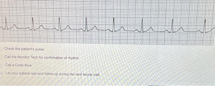 Solved 2nd Degree Heart Block Type II Sinus Rhythm with PJC | Chegg.com