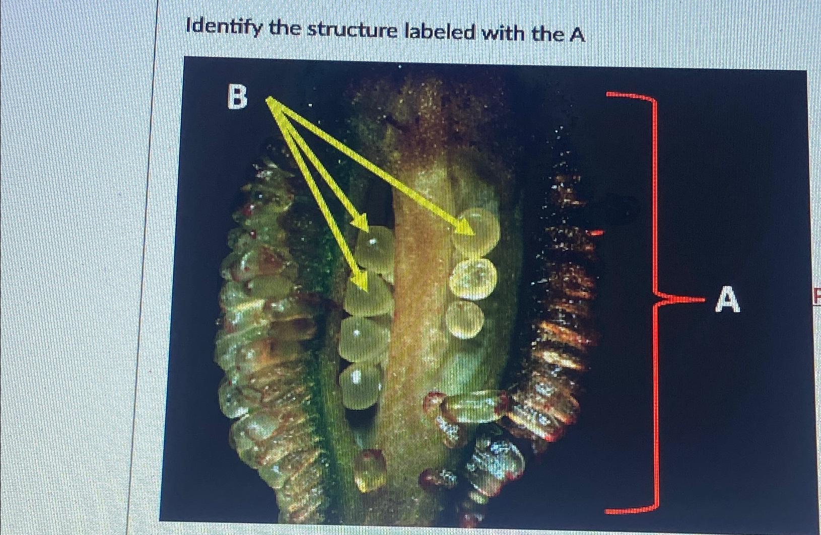 Identify the structure labeled A | Chegg.com
