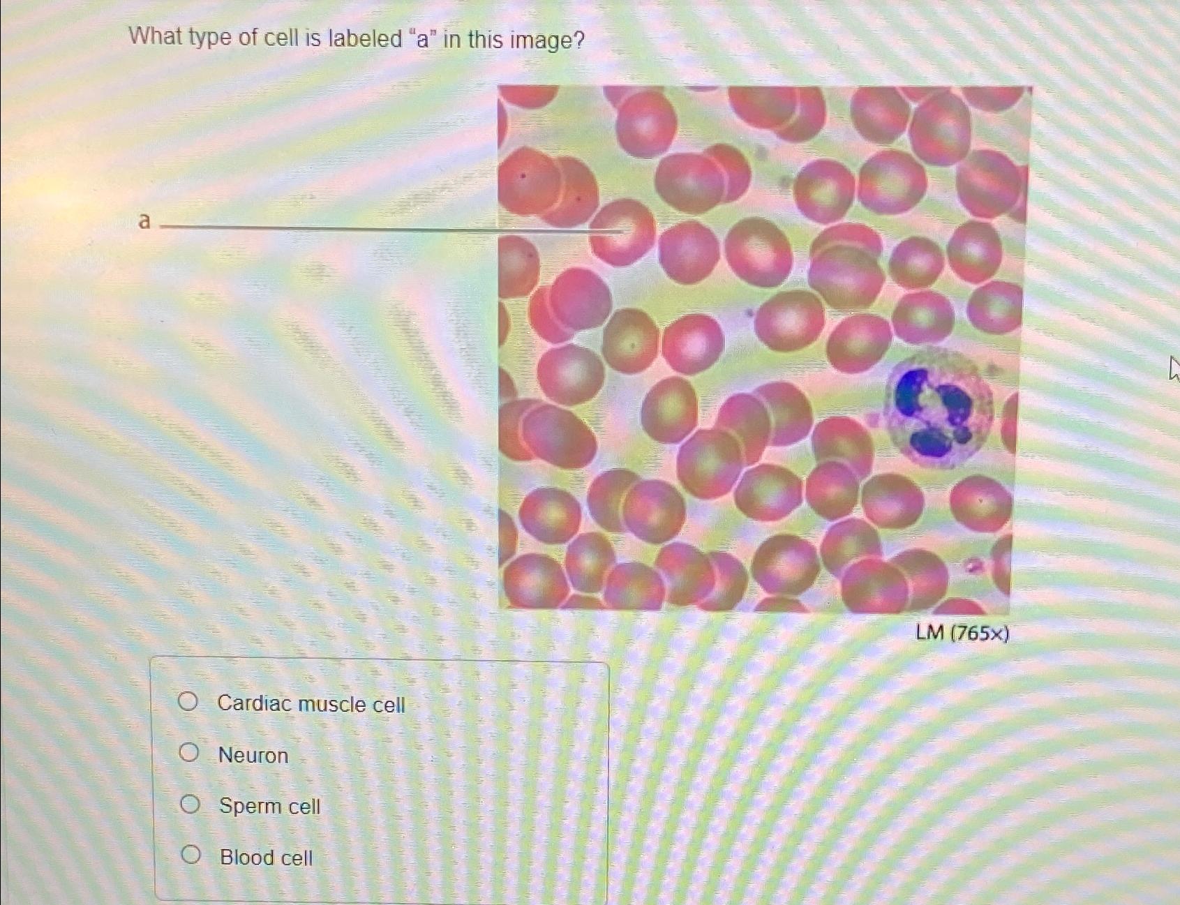 Solved What type of cell is labeled " a " ﻿in this | Chegg.com