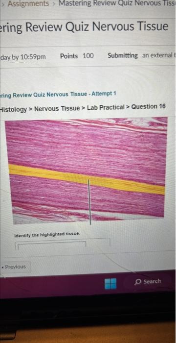 Solved Ring Review Quiz Nervous Tissue - Attempt 1 Histology | Chegg.com