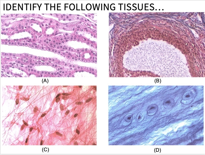 Solved IDENTIFY THE FOLLOWING TISSUES... (A) (B) (C) (D) | Chegg.com