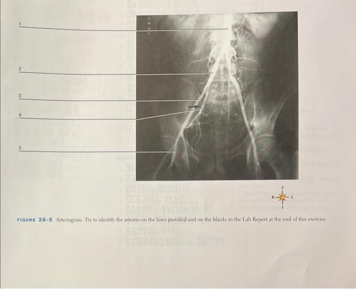 3
10
FIGURE 38-5 Arteriogram. Try to identify the arteries on the lines provided and on the blanks in the Lab Report at the e