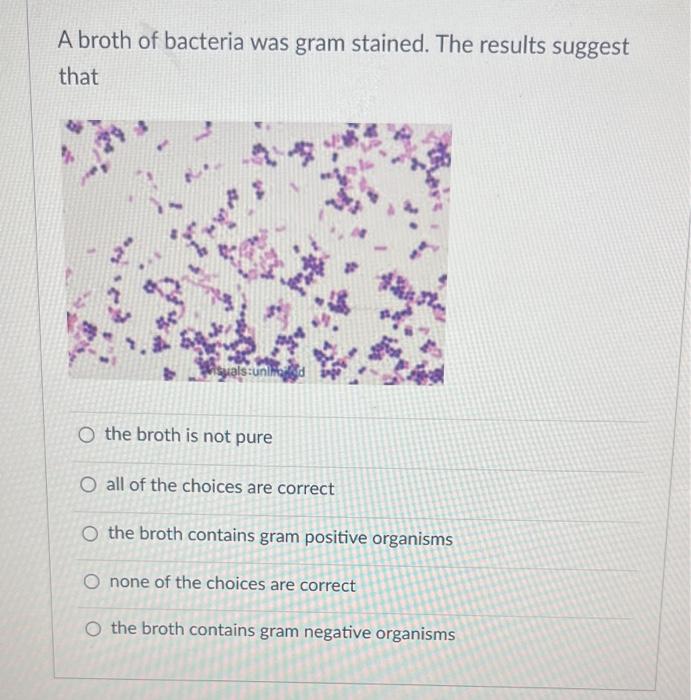 A broth of bacteria was gram stained. The results suggest that
the broth is not pure
all of the choices are correct
the broth