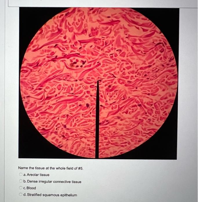 Solved Where in the body we find this tissue at the pointer | Chegg.com