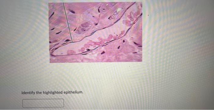 Identify the highlighted epithelium.