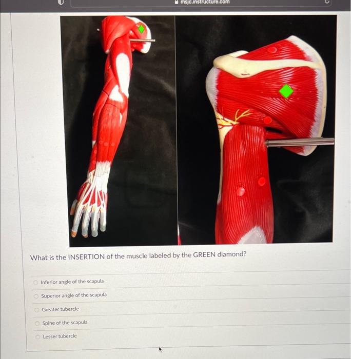 Solved What is the INSERTION of the muscle labeled by the | Chegg.com
