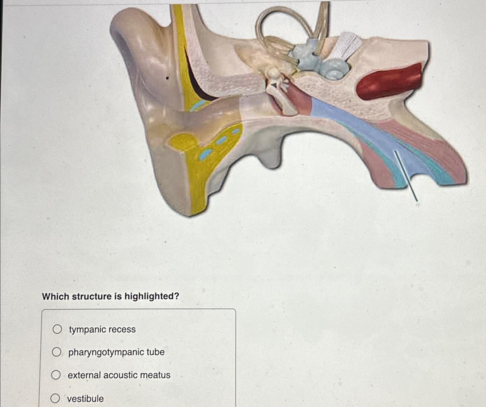 Solved Which structure is highlighted?tympanic | Chegg.com