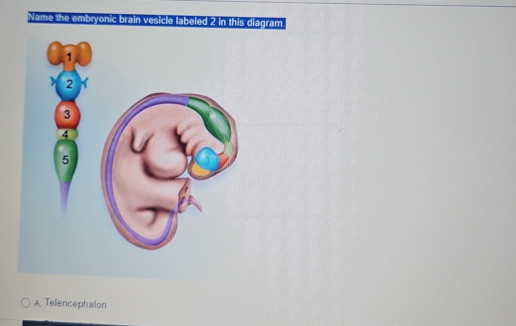 Name the embryonic brain vesicle labeled 2 ﻿in this | Chegg.com