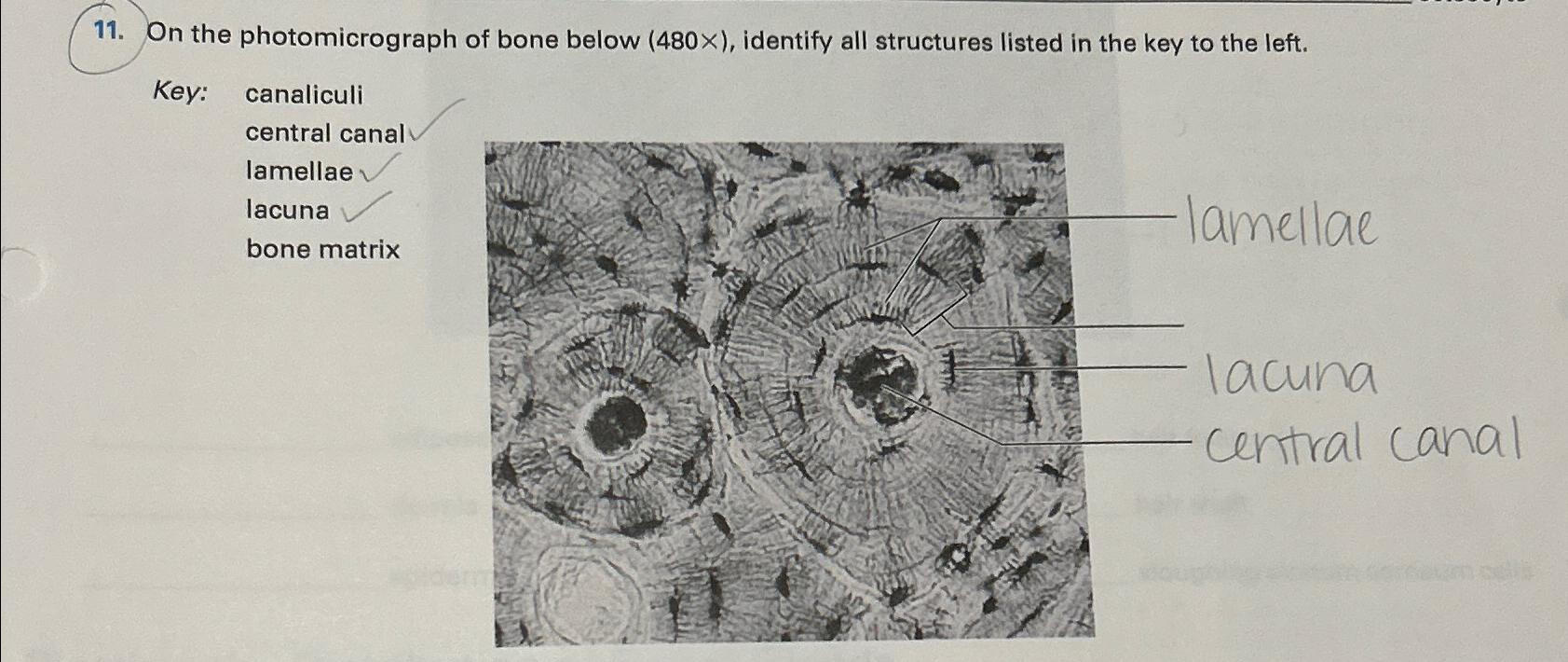 Solved On the photomicrograph of bone below (480×), | Chegg.com