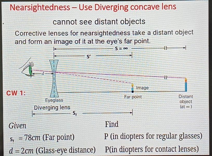 Solved Nearsightedness Use Diverging concave lens cannot