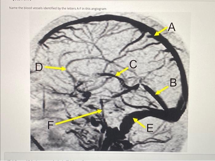Solved Name the blood vessels identified by the letters A-F | Chegg.com