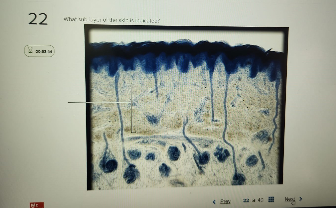 Solved 00:53:44What sub-layer of the skin is indicated? | Chegg.com