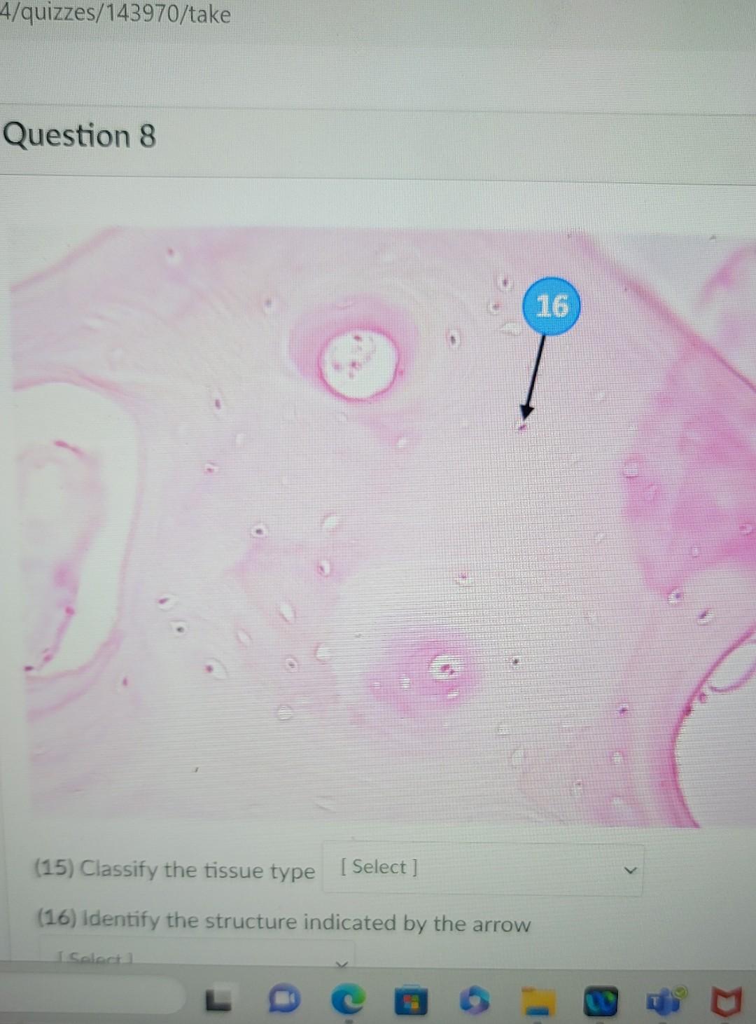Solved (9) Classify the tissue type [ Select ] (10) Identify | Chegg.com