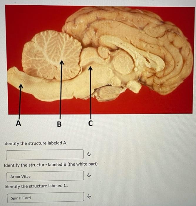 Solved A B C Identify the structure labeled A. A/ Identify | Chegg.com