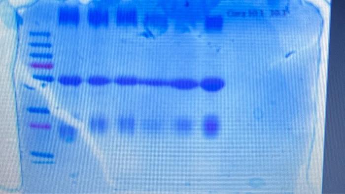 Solved can i plz have an analysis on the schematic gel and | Chegg.com