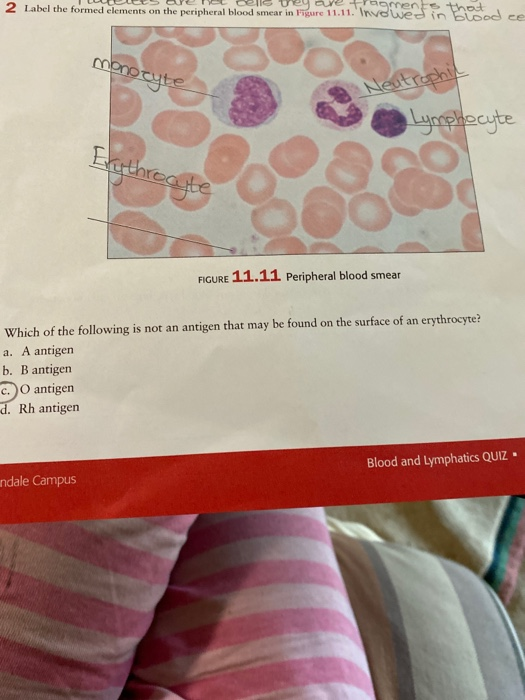 Label The Formed Elements On The Peripheral Blood Smear In Figure 20 7 ...