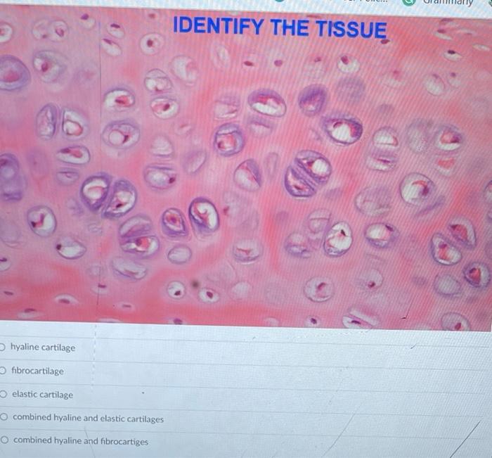 Solved IDENTIFY THE TISSUE hyaline cartilage fibrocartilage | Chegg.com