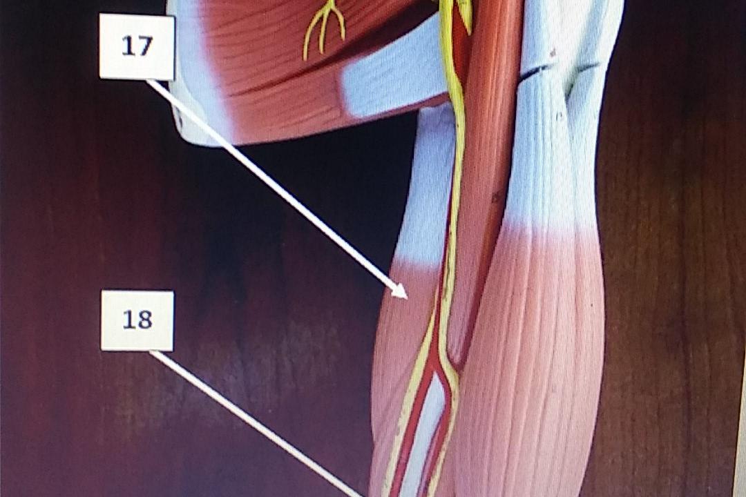 Solved 12. The runs through the bicipital groove. A.